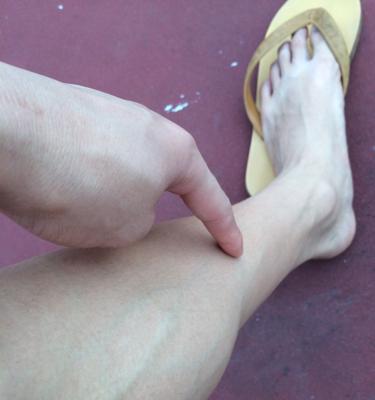 打篮球防守时大腿一扭很痛（如何应对篮球比赛中的伤痛？）
